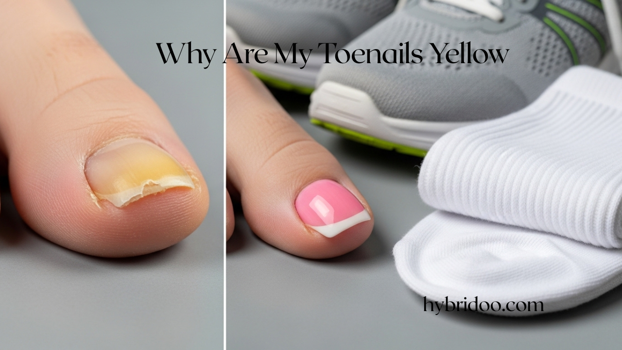 Why Are My Toenails Yellow